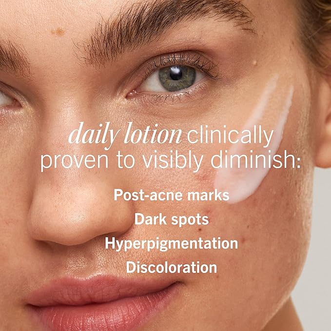 First Aid Beauty Lactic Acid Lotion for Acne-Prone Skin with 2% Niacinamide - Resurfacing Lotion Moisturizes & Visibly Diminishes Post-Acne Marks, (1.0 oz)