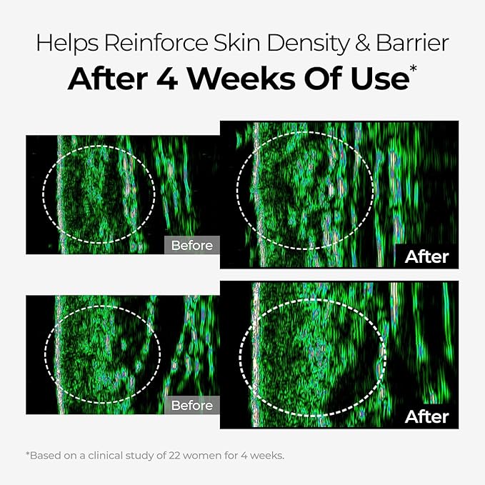 DOMINAS Niacinamide & Tranexamic Acid Cream | Korean Skincare for Even Skin Tone | With Bakuchiol & Panthenol (1.76oz)