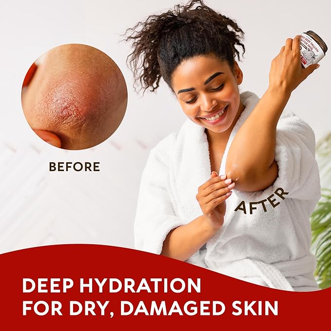 Beef Tallow for Skin – Whipped Tallow and Honey Balm with Grass-Fed Beef Tallow – Organic Daily Tallow Face Moisturizer & Body Balm – Deep Nourishment for Dry, Cracked, Sensitive Skin - 4.3 OZ