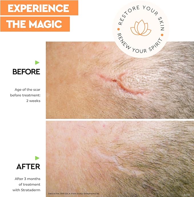 Strataderm Professional Scar Therapy Gel | Old and New Scars from General Surgery, Trauma, Wounds, Burns, Bites, Acne & Skin Disease | Reduces Redness, Discoloration, Discomfort & Itch | 5g (0.17oz)