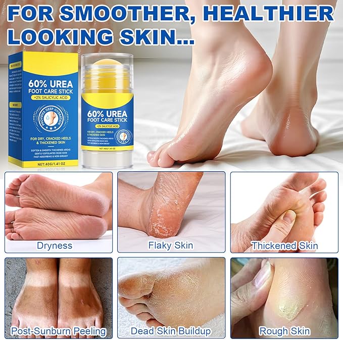 Urea Foot Cream, Urea Cream 60 Percent for Feet, Foot Cream for Cracked Heels and Dry Skin, Cracked Heel Repair Cream Plus 2% Salicylic Acid, for Calluses and Hard Skin 2PCS