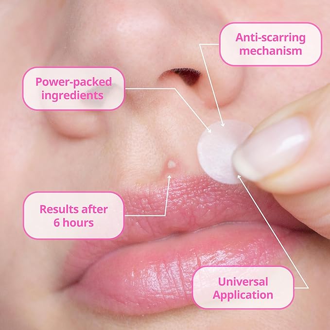 The Anti Scarring Patch (48 Patches) | Bespoke Formula Pimple Patches for Face to Fight Acne & Minimize Scars | Results After 6 Hours | Strategically Curated Ingredients | Created By Dermatologists