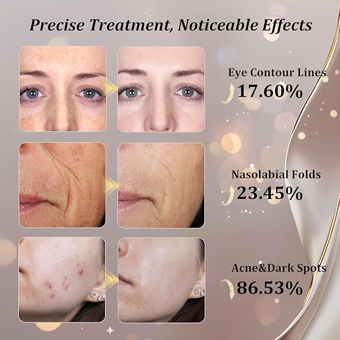 Red Light Therapy for Face, FDA-Cleared 8-Modes Red Light Therapy Mask for Wrinkles, Acne Treatment, and Skin Care, Portable Facial Mask, Unique Gift for Women - Mom, Sister, Girlfriend, and Wife