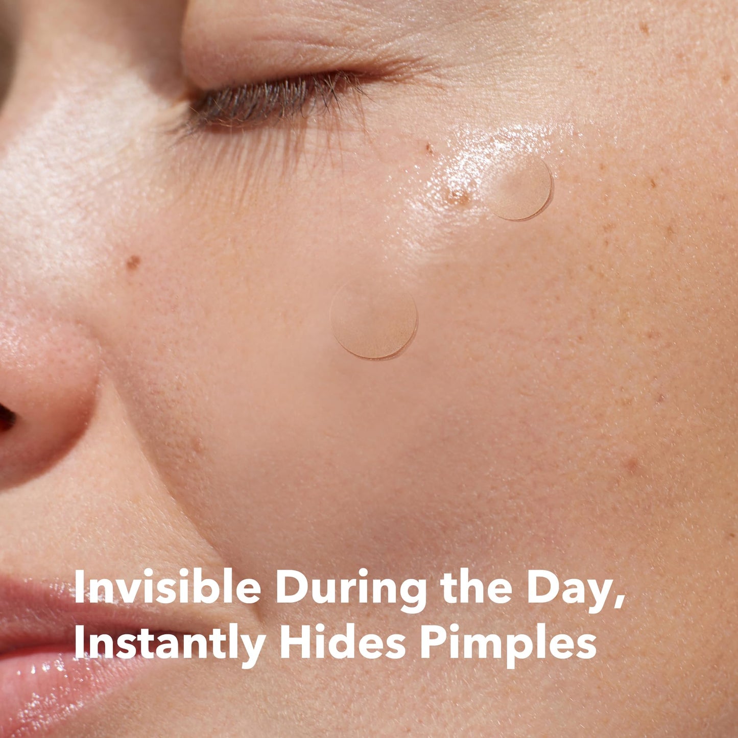 AVARELLE Hide-and-remove Kit Pimple Patches | Hydrocolloid Acne Patches for Blemishes and Zit for Face, Vegan, Cruelty Free