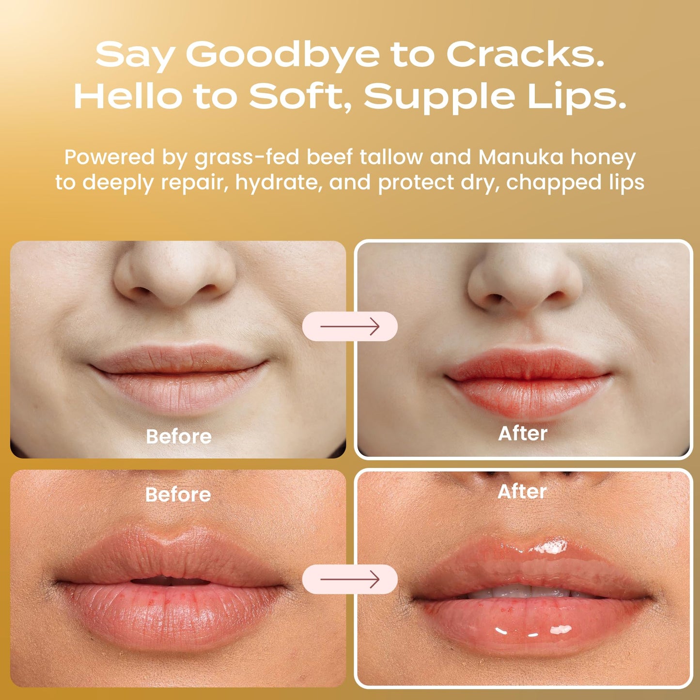 Body Restore Grass Fed Beef Tallow Lip Mask, with Manuka Honey – Christmas Stocking Stuffers, White Elephant, Hydrating Moisture, Travel Essentials, Self Care, Birthday Gifts for Women, Men – Vanilla