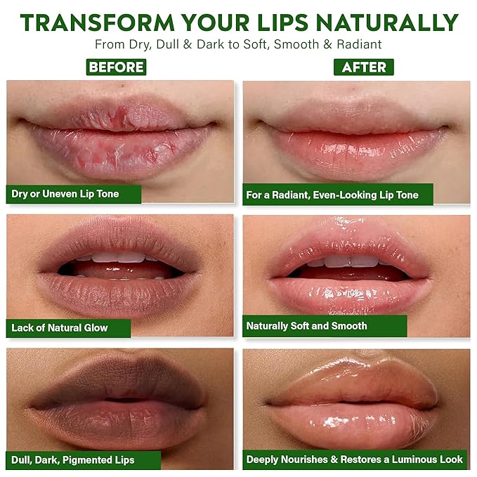 Vegan Ayurvedic Lip Balm – Lightens Dark Lips & Brightens Tones – Deeply Hydrating & Moisturizing for Dry, Chapped Lips – Plant-Based