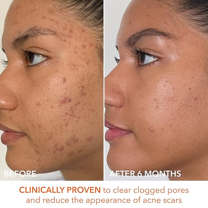 Dr. Dennis Gross Alpha Beta Extra Strength Daily Peel – 2-Step Exfoliating Pads for Enhanced Anti-Aging, Smoother Skin, and Radiant Complexion, 60 Treatments