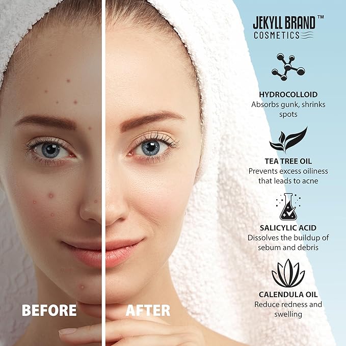 Cosmetics™ | Nose Pore Patches - XL (12counts) | Hydrocolloid | Medical Grade Facial Skin Care | Target Zits and Pimples | Absorbs Acne Nose Gunk | **Dermatologist Approve**