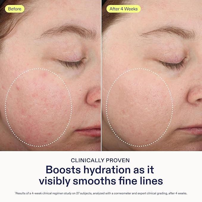 Skinfix Triple Lipid-Peptide Lotion - 1.7 oz - Lightweight, Hydrating Face Moisturizer - Non-Comedogenic - Fragrance Free - Vegan, Cruelty Free