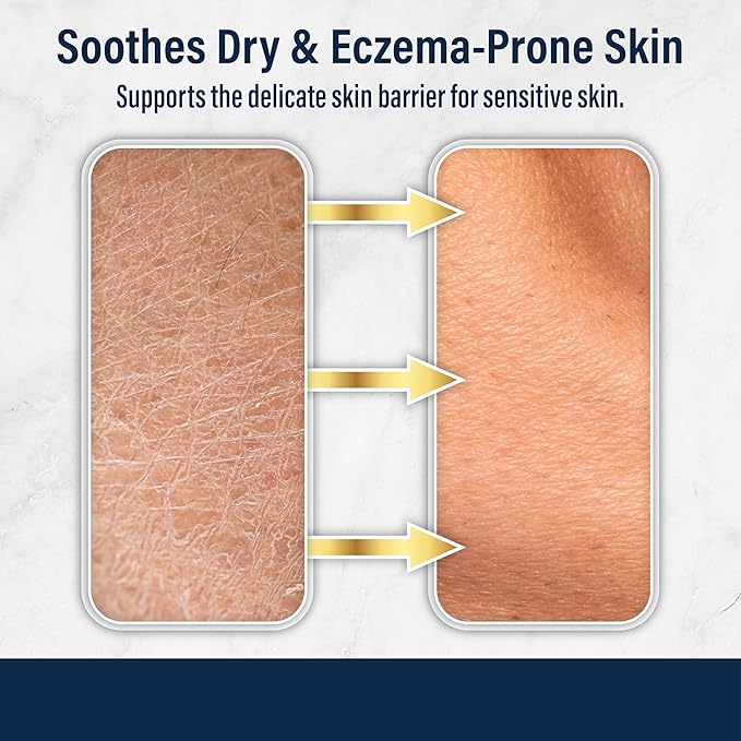 Dr. Eddie's Dermal Defense Moisturizing Cream - Face and Body Moisturizer for Dry Skin, Daily Cream for Sensitive Skin Care, Ultra Moisturizing Eczema Cream for Men and Women - 12 fl oz