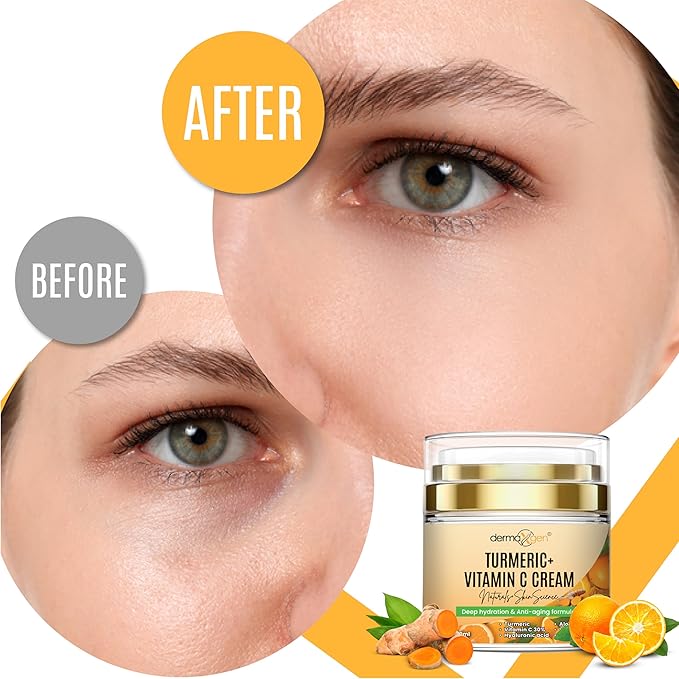 Turmeric Face Cream with 30% Vitamin C – Hydrating Glow Boosting Moisturizer for Normal, Dry, Oily, and Combination Skin – Organic Ingredients – 1.7 FL OZ