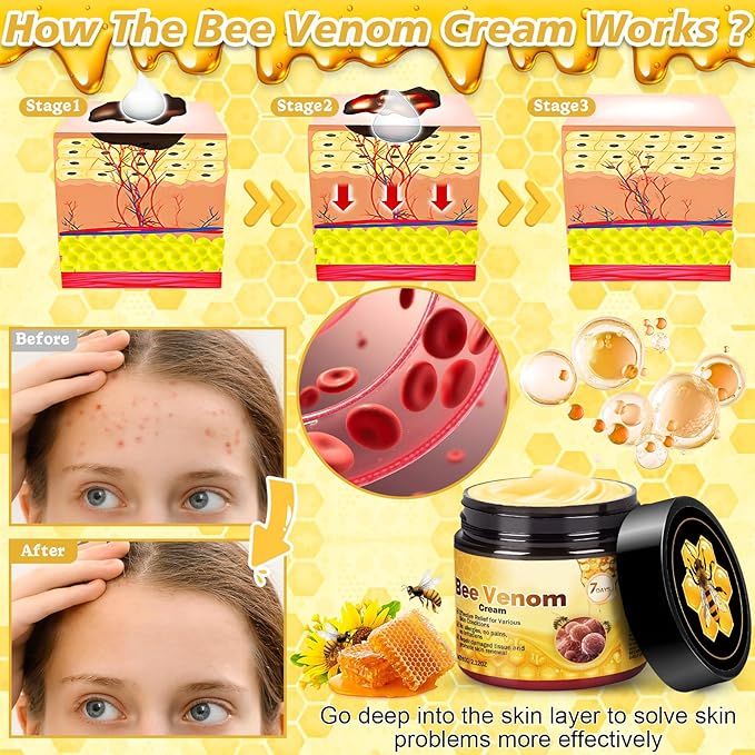 Bee Venom Skin Treatment Cream, 2025 New Professional Bee Venom Repair Cream, Advanced Firming & Wrinkle-Reducing Natural Skin Moisturizer for All Skin Types (2 Bottles)