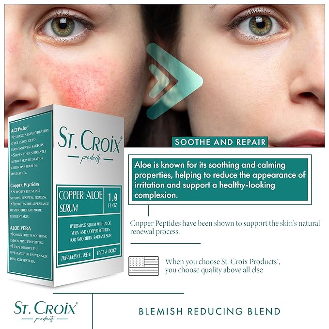 Copper Aloe Serum - Soothing Aloe Concentrate with Copper Peptides - 1 oz