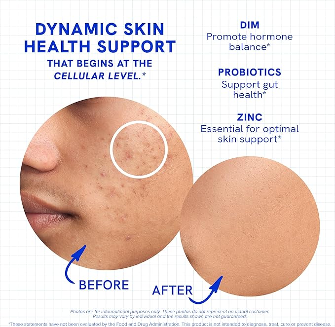 Clear Skin Acne Supplement with Zinc, DIM & Probiotics | 3-in-1 Balance, Clarify, Restore Support with Hyaluronic Acid & Skin Support Vitamins | for Women & Men | Oral Hormonal Acne Pills | 120 Ct