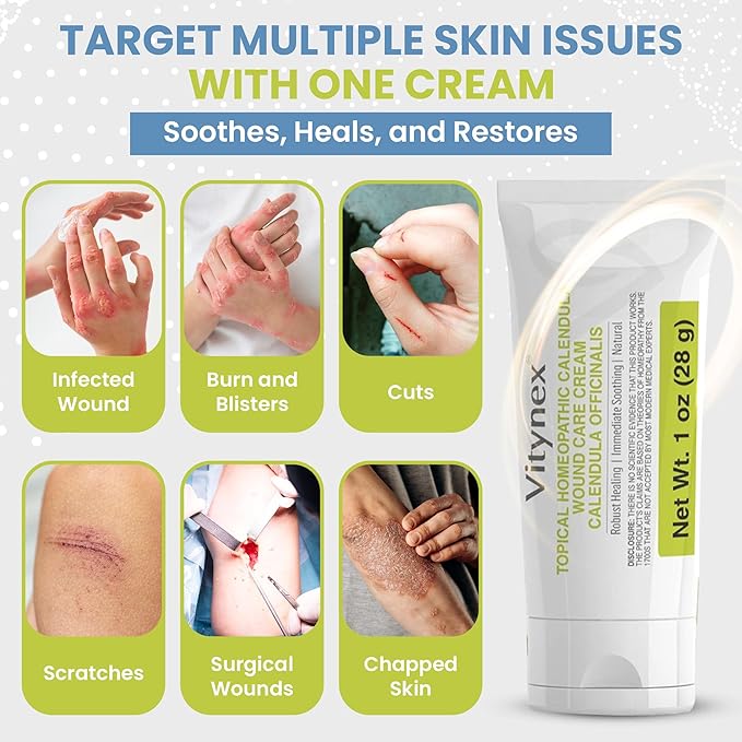Skin Repair Wound Care Cream – 1 Oz Scar Prevention Cream First Aid Wound Ointment for Burns, Bites, Cuts, Ulcers, Abrasions – Deeply Nourishing Calendula Healing Ointment with Natural Ingredients