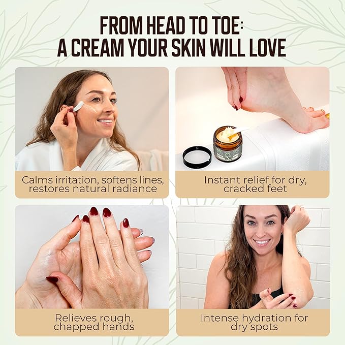 Grass-Fed Beef Tallow and Manuka Honey Balm, Eczema Face & Body Cream, Moisturizer for Dry Skin with Shea Butter, Almond & Jojoba Oil, Beeswax, Arrowroot, Vitamin E - Lemongrass - Made in Canada, 2 oz