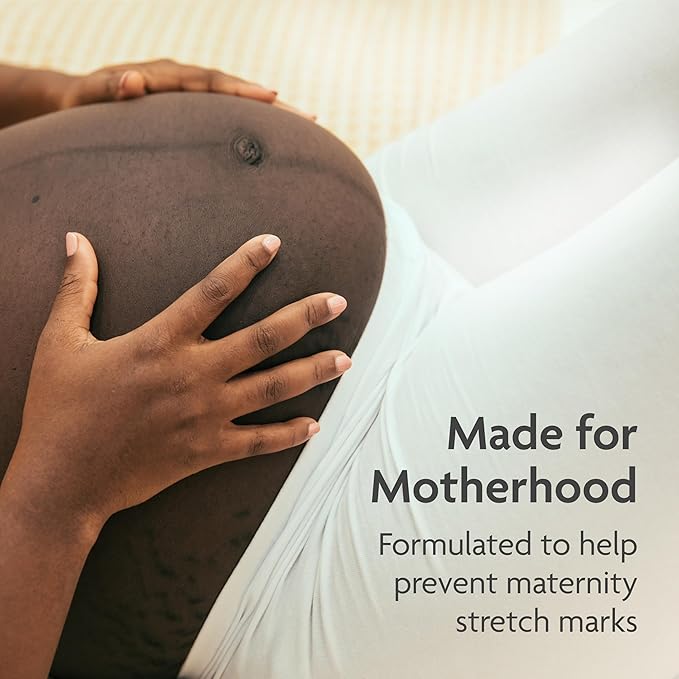 TriLASTIN Stretch Mark Cream for Pregnancy - 5.5 Oz Tube - Vitamin-Infused Cocoa Butter Formula - Intensive Scar Treatment - Hypoallergenic & Paraben-Free