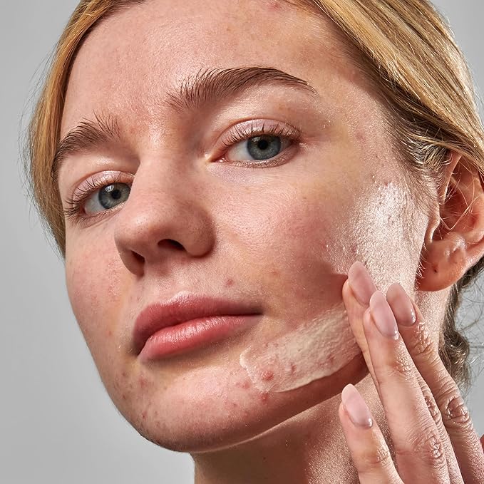 The INKEY List SuperSolutions Novoretin 2% Moisturizer, Skin Clearing Moisturizer to Reduce Blemishes and Breakouts While You Sleep, Non-Comedogenic 1.69 fl oz