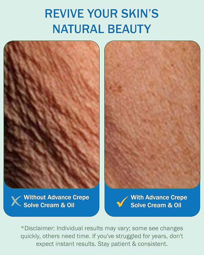 Crepe Cream for Aging Skin Women Men 2 Pack - with Natural Oils, Licorice Root & Chamomile Extract - Crepey Skin Tightening Cream for Body, (4 fl oz) Made in USA