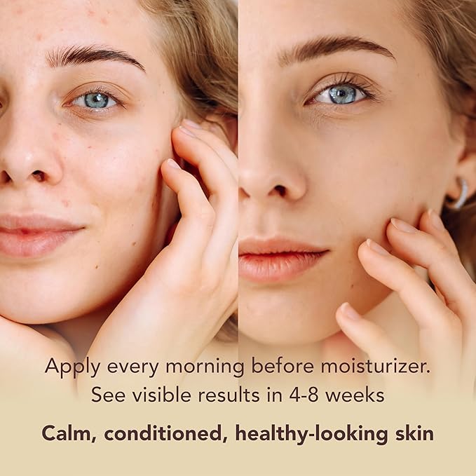 MATKAS Korean Antioxidant 2% Niacinamide Serum for Face with Cica - 30mL - Hyaluronic Acid Moisturizer and Centella Ampoule Serum for Glowing Skin, Anti Redness Niacinamide Pore Minimizer + Ceramide