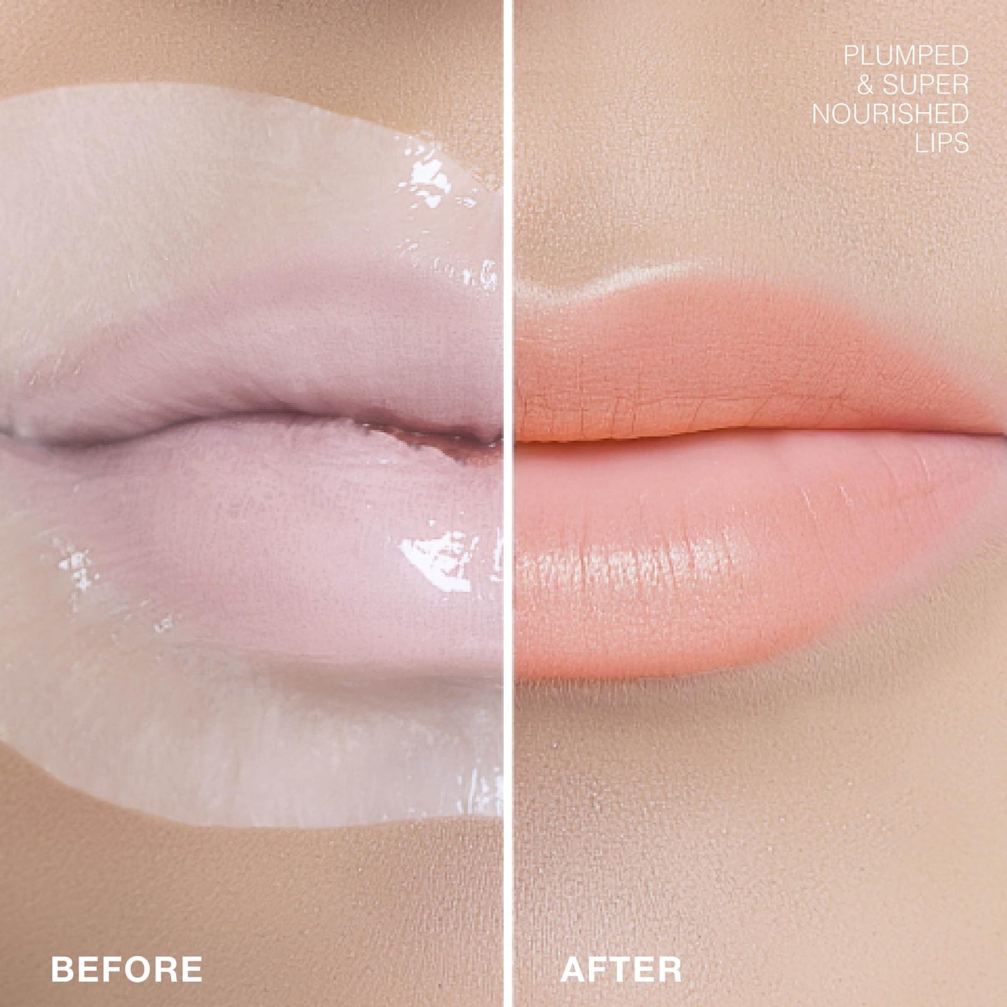 STARSKIN Dreamkiss 2x5g, Hydrating & Plumping Bio-Cellulose Lip Mask, Anti Wrinkle Patches for Lip, Evens Fine Lines & Wrinkles