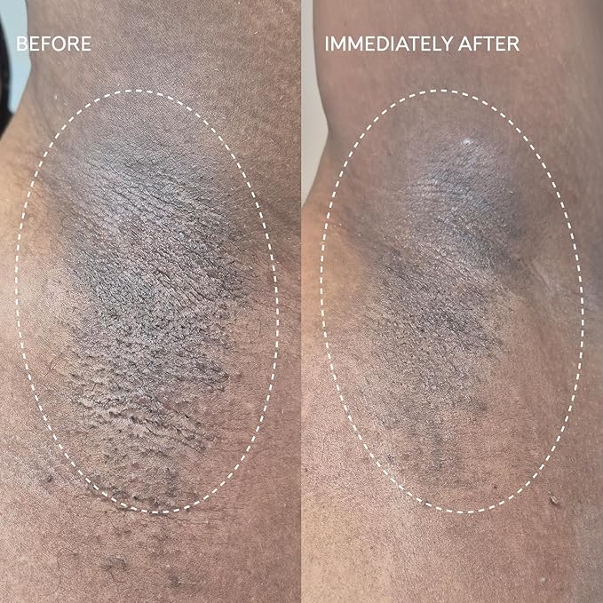 Fur Flash Repair Jelly – Hypochlorous Acid Aftercare Gel for Post-Wax, Shave, or Laser – Soothes Redness, Bumps, and Irritation Dermatologist-Tested, Fragrance-Free (2.0 fl oz / 60mL)