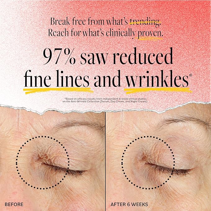 DERMA E Face Serum, Anti Aging Regenerative Retinol Serum for Face, 1 Fl Oz, Vitamin A, Bakuchiol, Glycolic Acid, Green Tea Extract, Helps Reduce Appearance of Fine Lines and Wrinkles