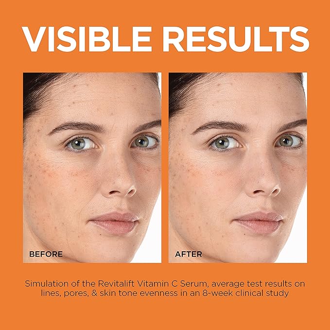 L'Oreal Paris Revitalift 12% Pure Vitamin C Serum, Brightening Serum For Face with Vitamin E, Salicylic Acid, 1 oz + Moisturizer Sample