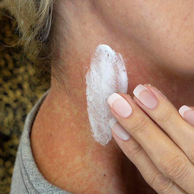 TriDerma Radia-Soothe Skin Relief Radiation Cream, FSA Eligible Helps Relieve Radiation Burn, Radiodermatitis and other Skin Damaging Side Effects from Radiation Therapy, Fragrance Free, 4 oz tube